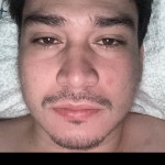 56f6310