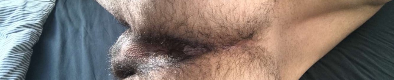 HairyScruff