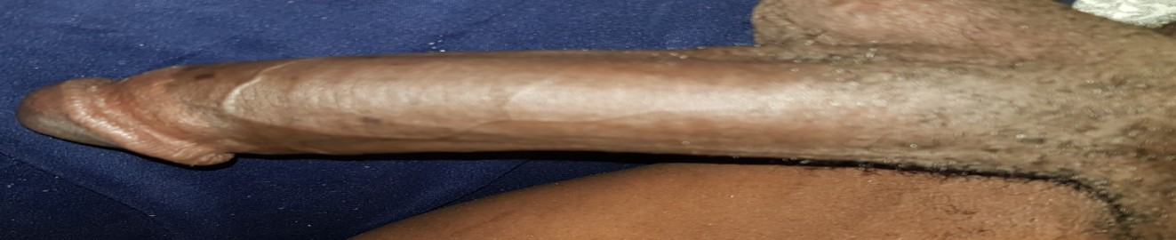 VhaUmte