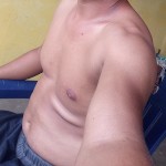 Ricura25