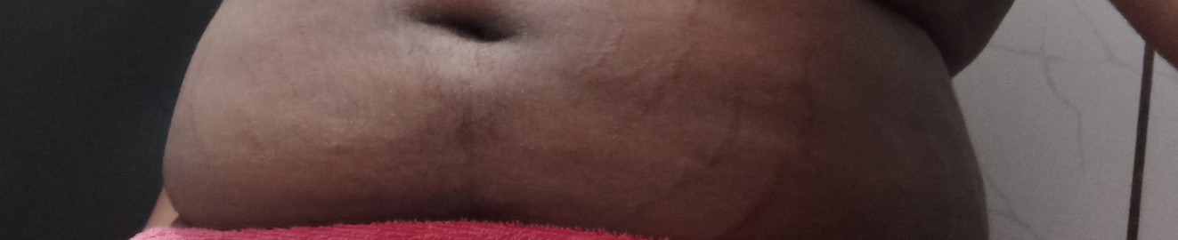 NegoGordinho