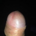 Marcirondick