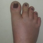 feetbyerin