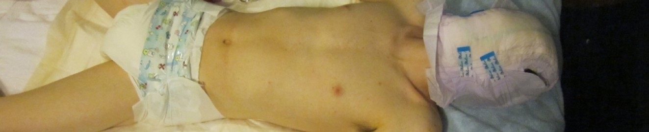 diaper-head_boy