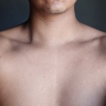 Scars Boy