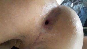 I dildo me I have dilated hole