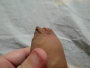 Slowly pulling back my foreskin