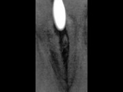 Massage Pussy With Toothbrush 10/16