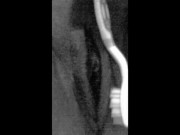 Massage Pussy With Toothbrush 6/16