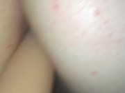 bigroundbooty anal torture 1/16