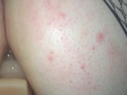 bigroundbooty anal torture 3/16