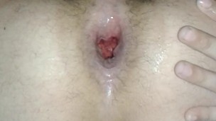 Huge anal gape
