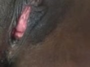 Kiss It