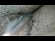 Hairy puss
