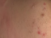 Just hony no concentration