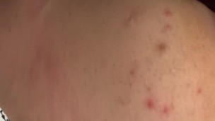 Just hony no concentration