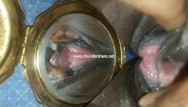Allergic reaction to vaginal fluids - I love mirrors full screen and in your face
