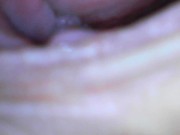 Gaping cunt and cervix show 1/16