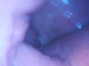 Gaping cunt and cervix show 12/16