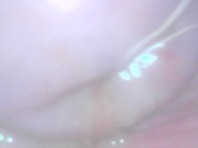 Gaping cunt and cervix show 15/16