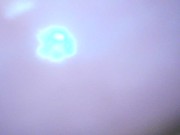 Gaping cunt and cervix show 16/16