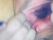 Gaping cunt and cervix show 3/16