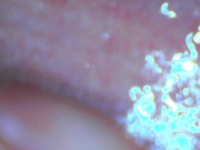 Gaping cunt and cervix show 5/16