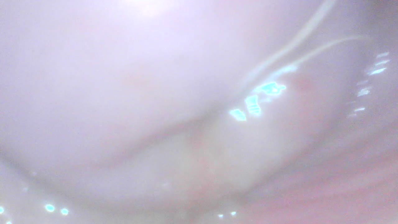 Gaping cunt and cervix show - Kostenloses Sex-Video - RedTube