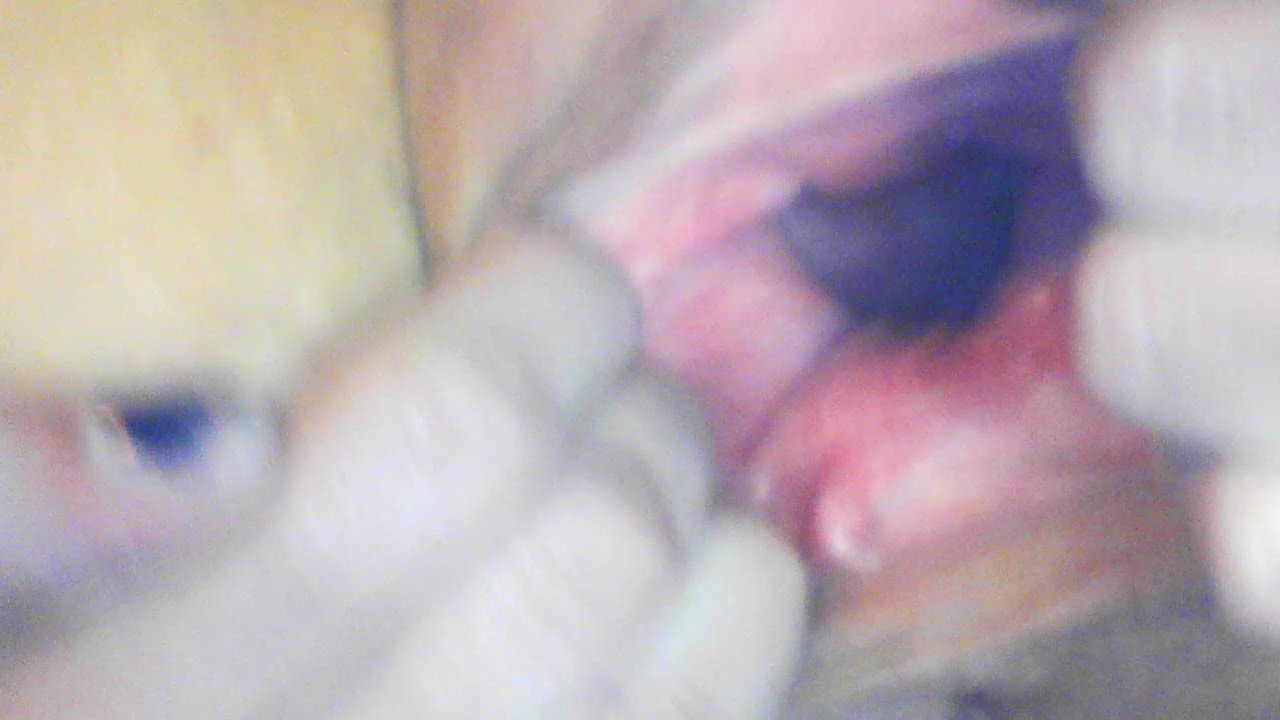 Gaping cunt and cervix show - Kostenloses Sex-Video - RedTube
