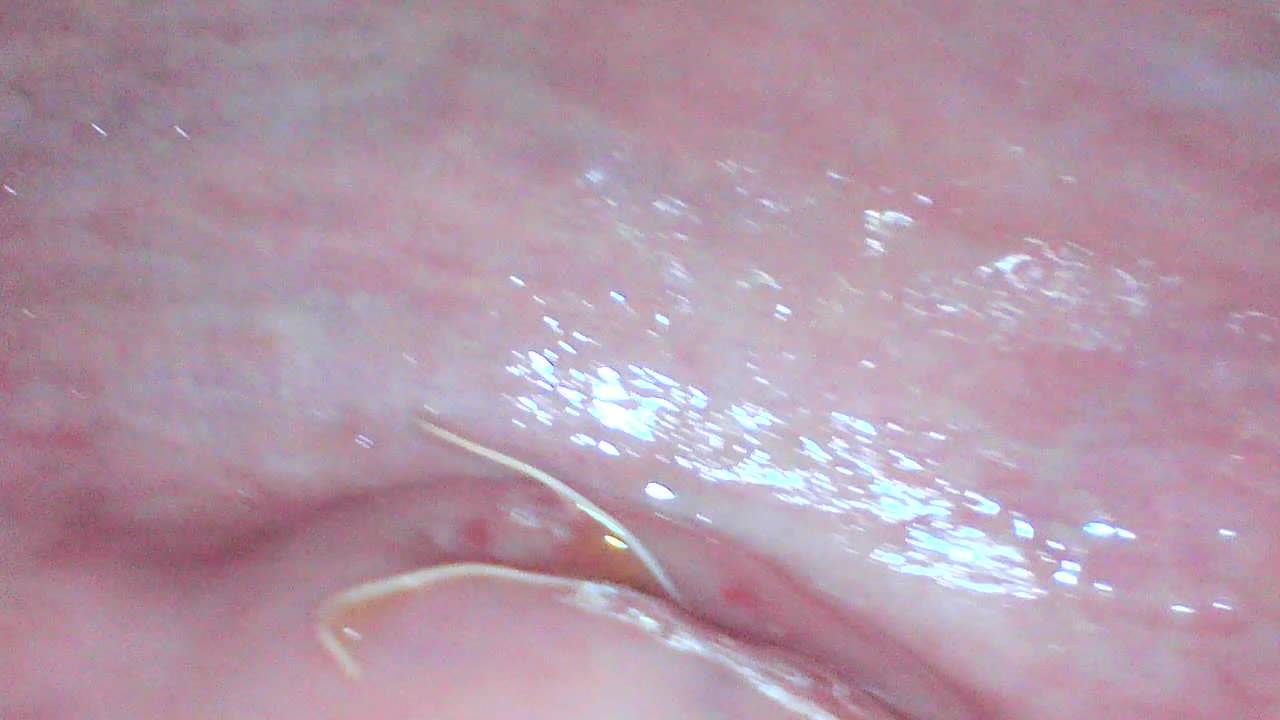 Gaping cunt and cervix show - Kostenloses Sex-Video - RedTube