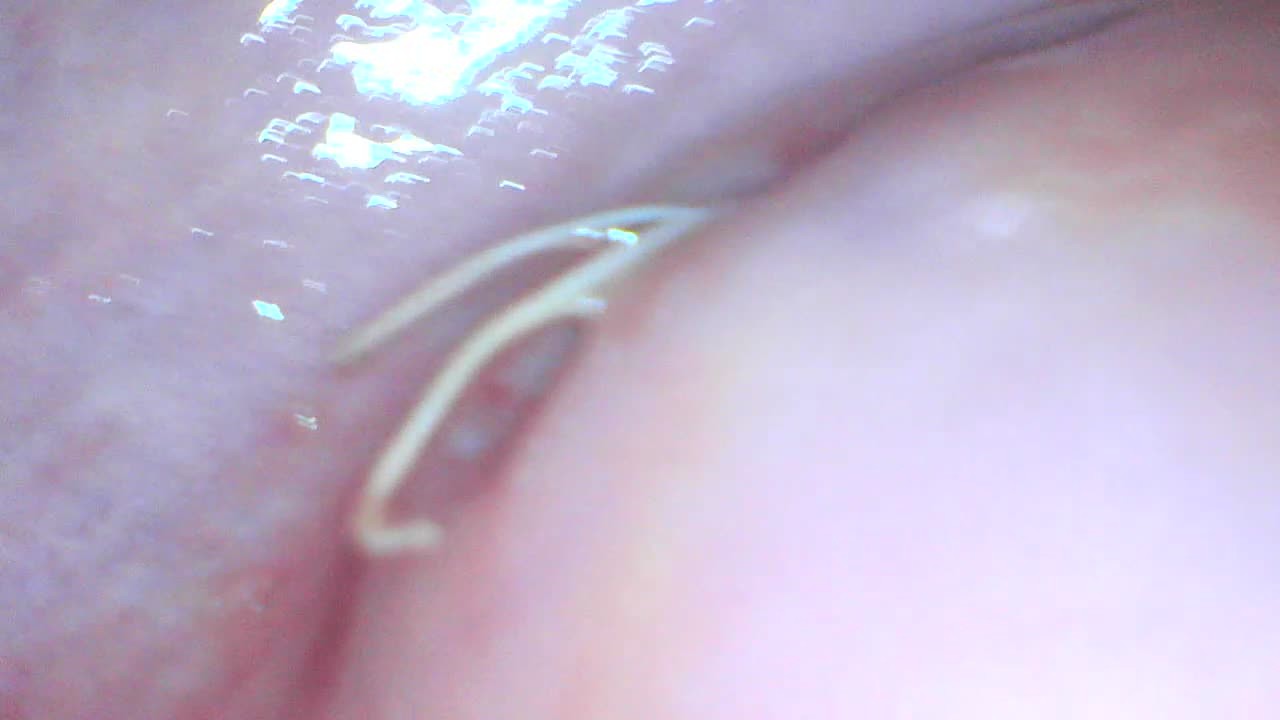 Gaping cunt and cervix show - Kostenloses Sex-Video - RedTube