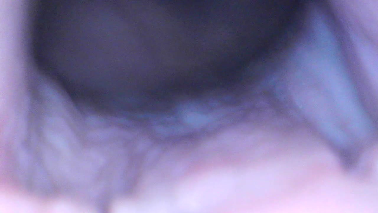 Gaping cunt and cervix show - Kostenloses Sex-Video - RedTube