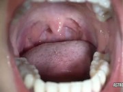 Are you sure you want to swing down past the uvula of Astrodomina?