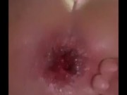 anal gaping 11/16