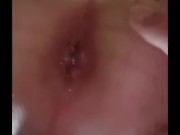 anal gaping 12/16