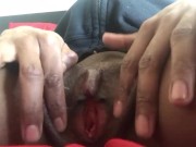 Muscle clit rubbed off 7/16