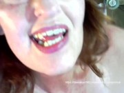 V16 Custom 3 derrick 5/16