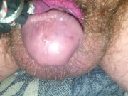 Electro my tiny worthless penis plz humiliate it