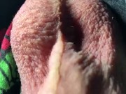 Moving testicles