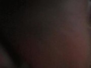  Amazing Huge Pussy Lips ♡¿♡