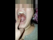 Girl bites fingers Very Hard