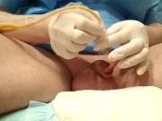 Insert catheter after saline inflation