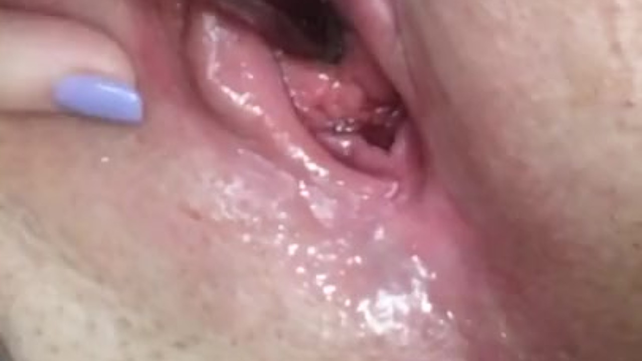 Peehole stretching, deep and thick - RedTube