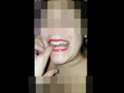 Girl Open wide Mouth 15/16