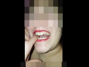 Girl Open wide Mouth 16/16