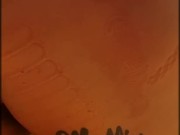 Babe baited at park 6/16