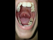 Girl Open Wide Mouth and Burping 13/16
