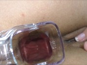 Anal fisting extreme and Speculum in ass 13/16