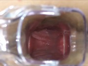 Anal fisting extreme and Speculum in ass 15/16