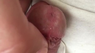 close up head massage "frenulum froid"